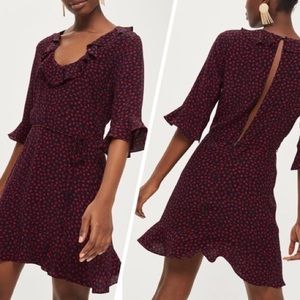 NWT TopShop Lip Print Open Back Dress